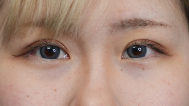 Postoperative Condition Part 1