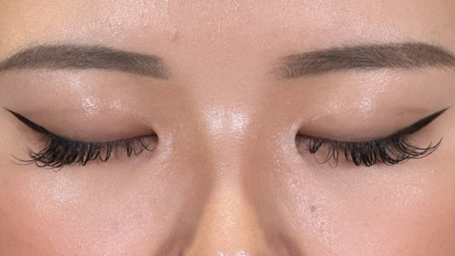 Postoperative Condition Part 1