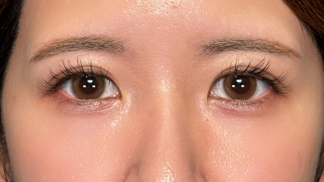 Postoperative Condition Part 1