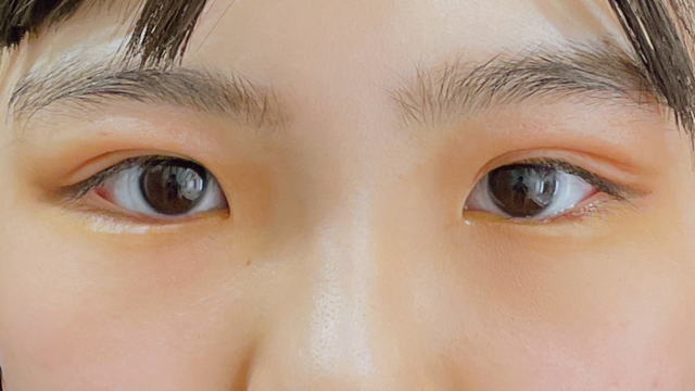 Postoperative Condition Part 1