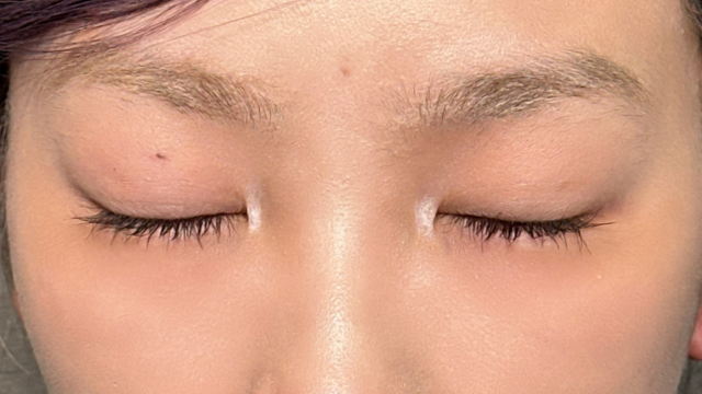 Postoperative Condition Part 1