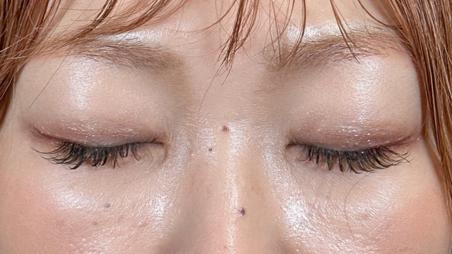 Postoperative Condition Part 1