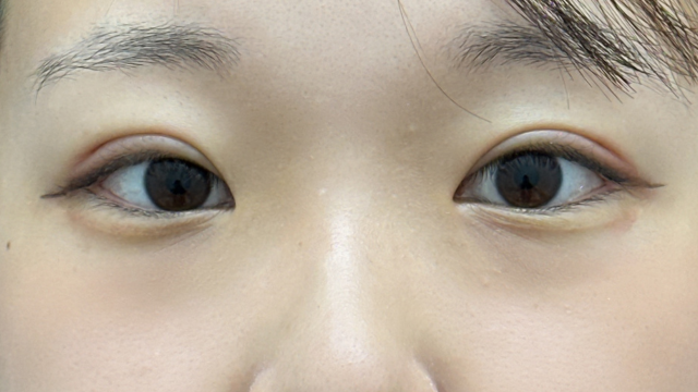 Postoperative Condition Part 1