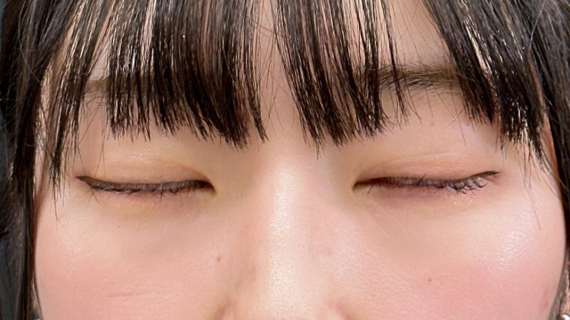 Postoperative Condition Part 1