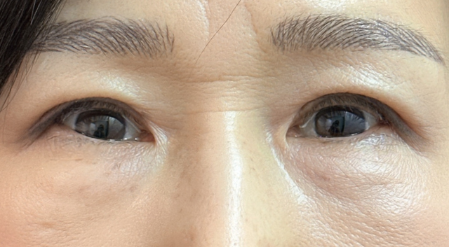 Postoperative Condition Part 1