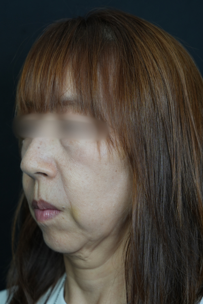 Postoperative Condition Part 1