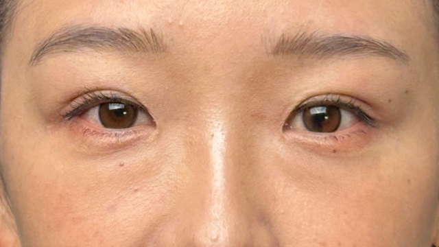 Postoperative Condition Part 1