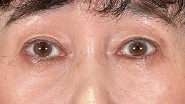 Postoperative Condition Part 1