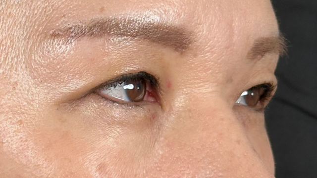 Postoperative Condition Part 1