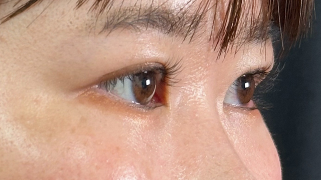 Postoperative Condition Part 1