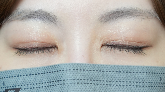 Postoperative Condition Part 1