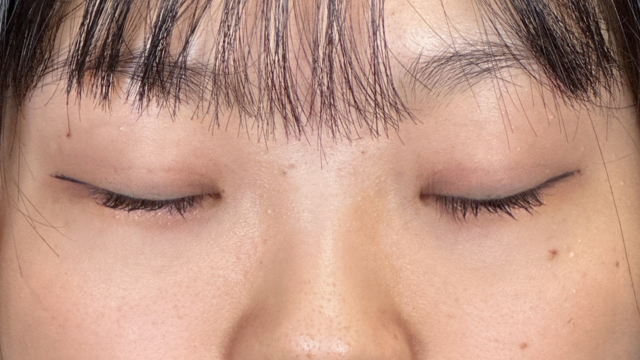 Postoperative Condition Part 1