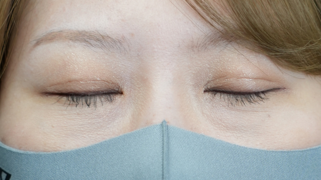 Postoperative Condition Part 1