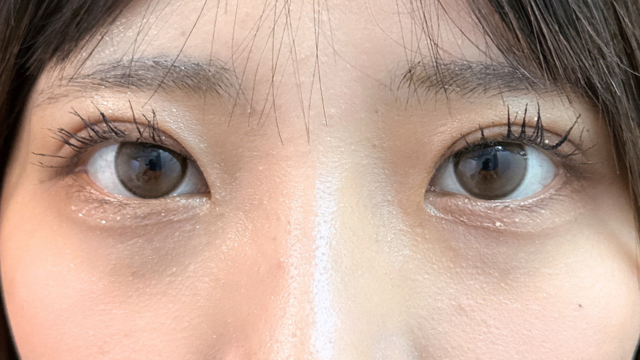 Postoperative Condition Part 1