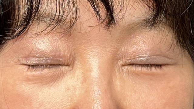 Postoperative Condition Part 1