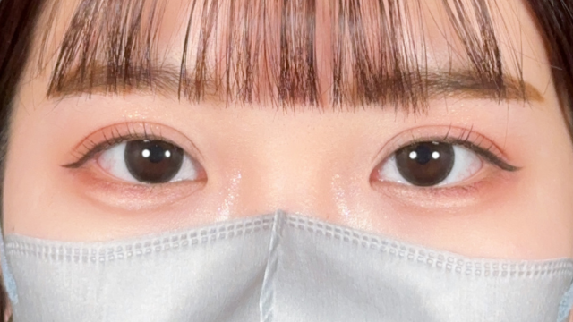 Postoperative Condition Part 1