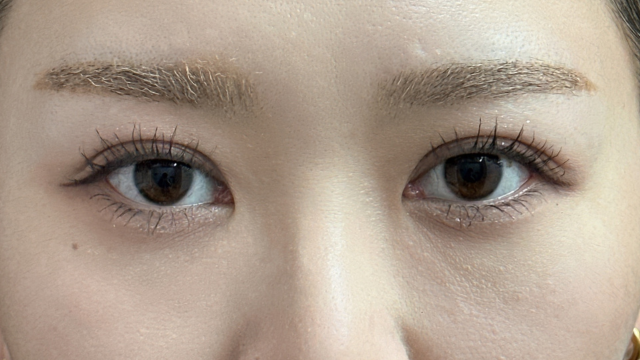 Postoperative Condition Part 1