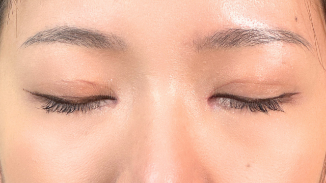 Postoperative Condition Part 1