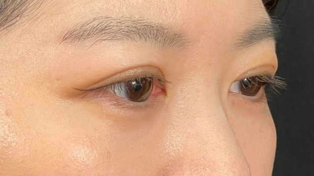 Postoperative Condition Part 1