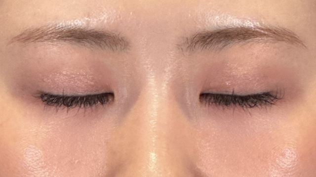 Postoperative Condition Part 1