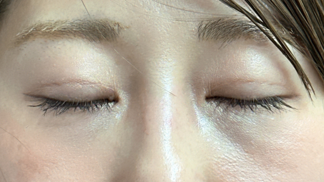 Postoperative Condition Part 1