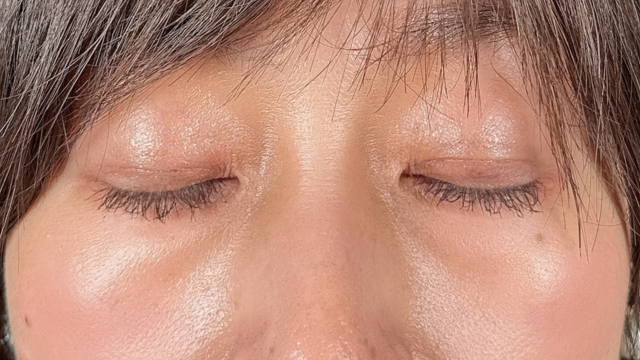 Postoperative Condition Part 1