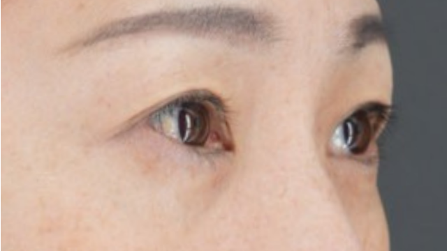 Postoperative Condition Part 1