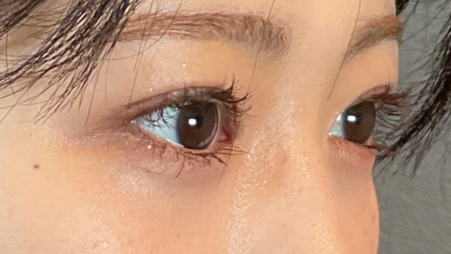 Postoperative Condition Part 1