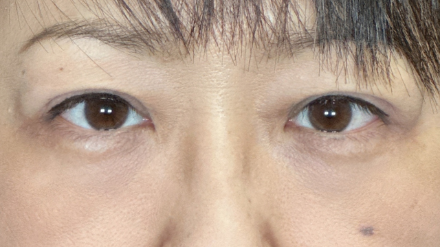 Postoperative Condition Part 1