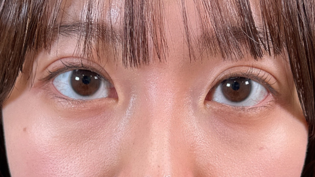 Postoperative Condition Part 1