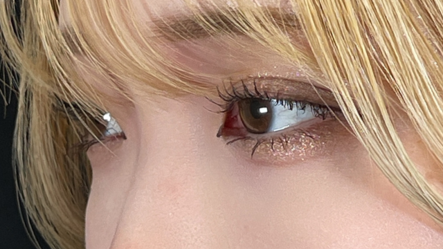 Postoperative Condition Part 1