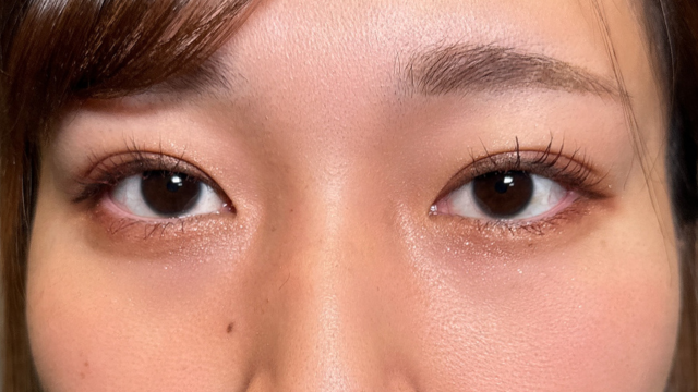 Postoperative Condition Part 1