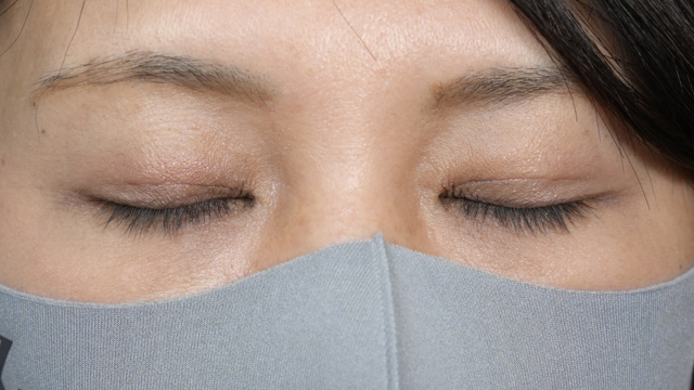 Postoperative Condition Part 1