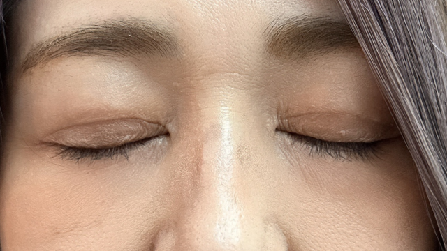 Postoperative Condition Part 1