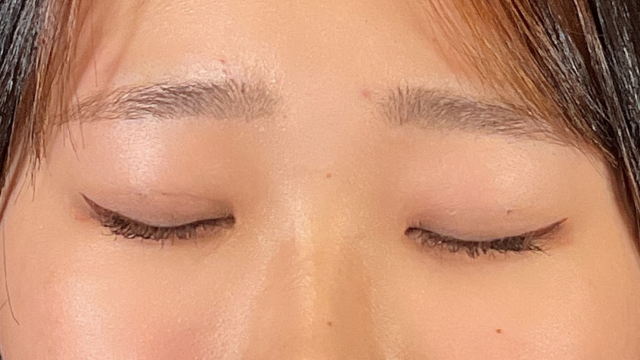 Postoperative Condition Part 1