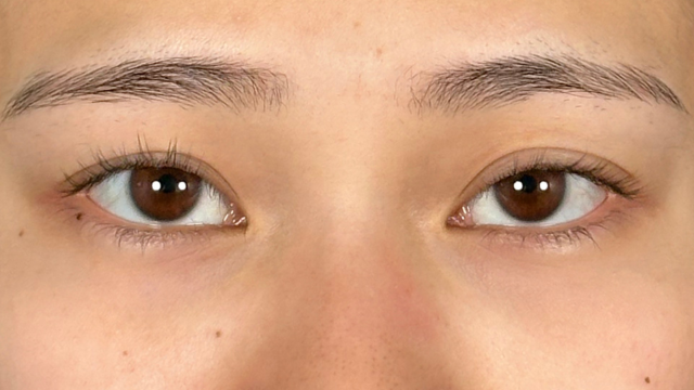 Postoperative Condition Part 1