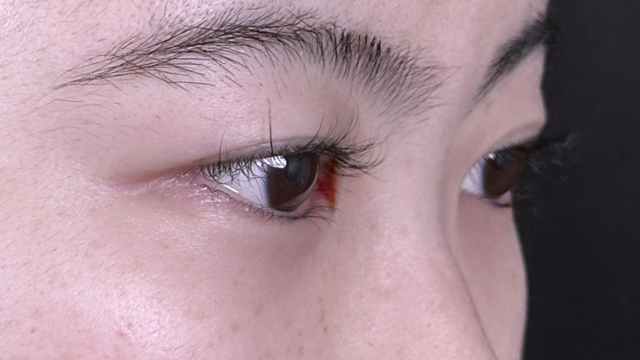 Postoperative Condition Part 1