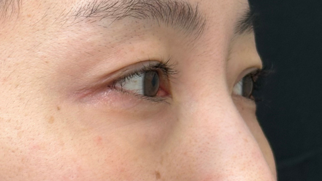 Postoperative Condition Part 1