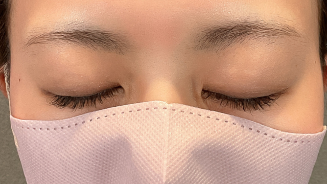 Postoperative Condition Part 1