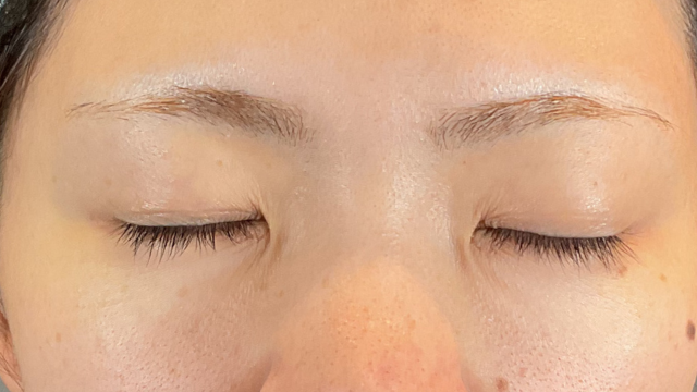 Postoperative Condition Part 1