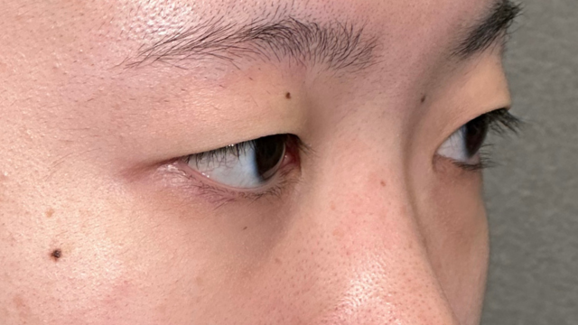 Postoperative Condition Part 1