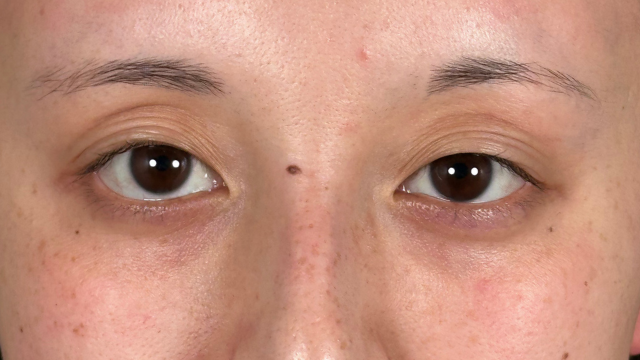 Postoperative Condition Part 1