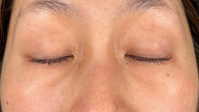 Postoperative Condition Part 1