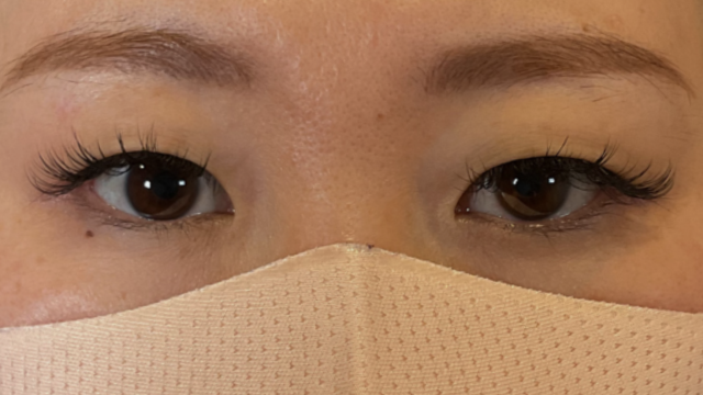 Postoperative Condition Part 1