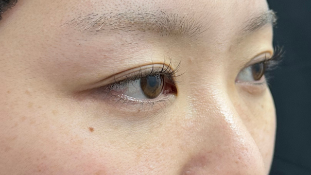 Postoperative Condition Part 1