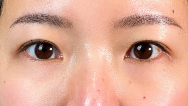 Postoperative Condition Part 1