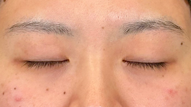 Postoperative Condition Part 1