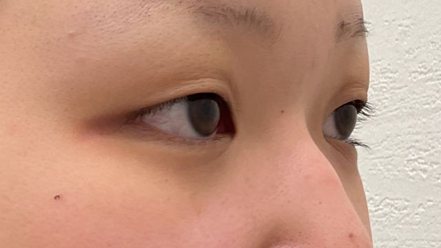 Postoperative Condition Part 1