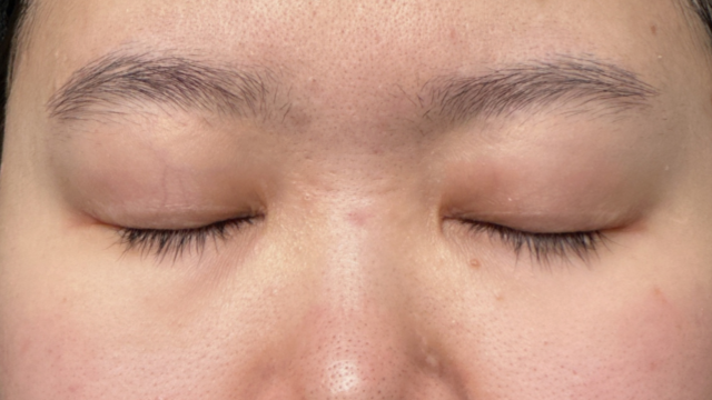 Postoperative Condition Part 1