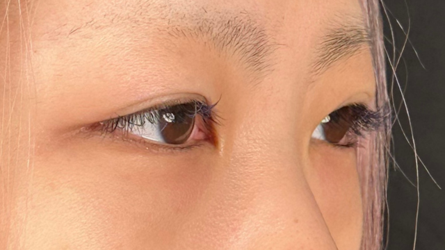 Postoperative Condition Part 1